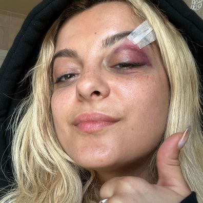 Bebe Rexha shares update for fans following assault on stage at concert.