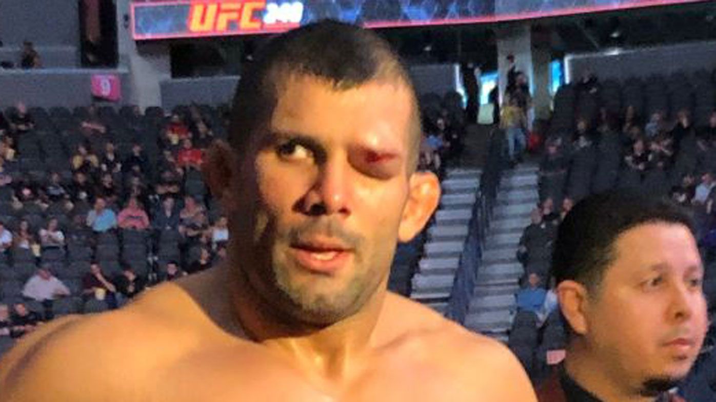 UFC 248 stunned by crazy eye injury to Rodolfo Vieira during submission victory