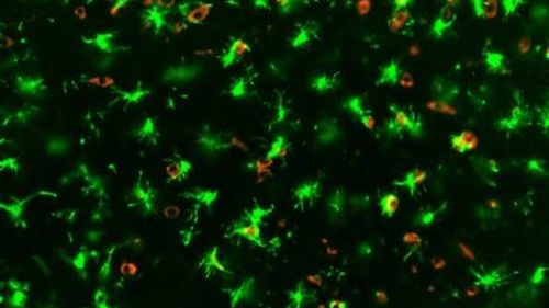 A COVID-19 infected mouse brain showing 'angry' microglia in green and SARS-CoV-2 in red.