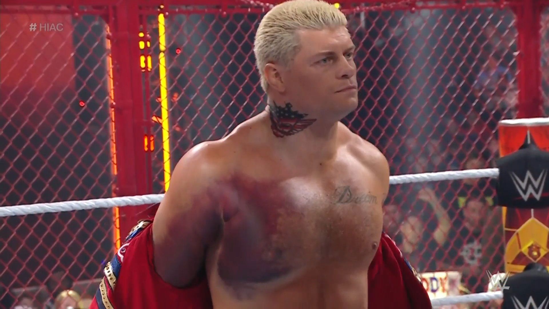 Cody Rhodes reveals a gruesome pectoral injury ahead of his fight against Seth Rollins.