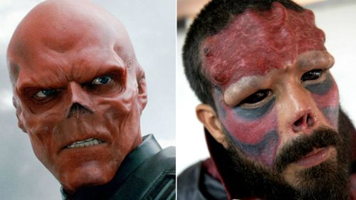 Man chops off nose to look like comic book villain
