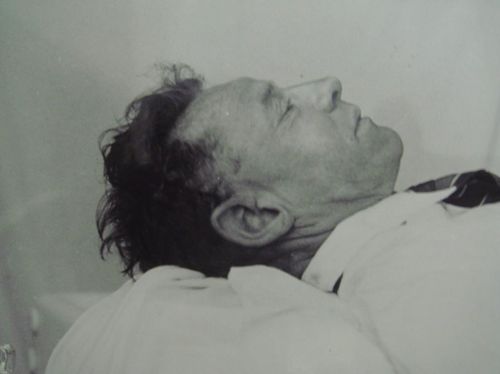 The Somerton Man shortly after autopsy