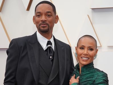 Jada Pinkett Smith alopecia