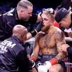 Jake Paul receives medical treatment during his cruiserweight title fight against Tommy Fury.