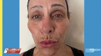 Beauty salon owners name and shame alleged 'Botox bandit'