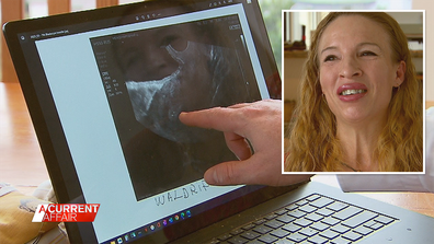 Aussie couple's journey to Russian clinic offering IVF guarantee