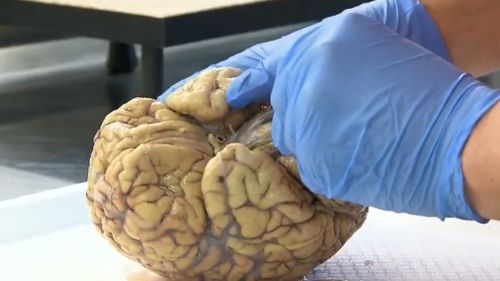 The Australian Sports Brain Bank is the first of its kind in the country. (9NEWS)