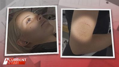 Photographs of Caitlin Thornton's injuries.