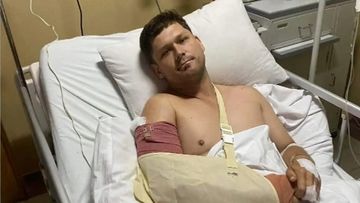 Josh Ward was hospitalised after he slipped and smashed into a glass door at a hotel pool in Denpasar on Christmas night.