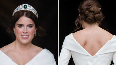 Princess Eugenie shows off her scoliosis surgery star at her recent wedding.