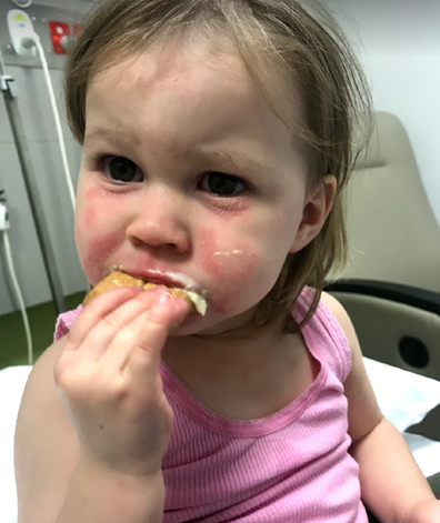 Poppy eczema eating a sandwich in hospital