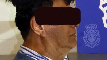 A Colombian man tried to smuggle cocaine under his oversized hairpiece.