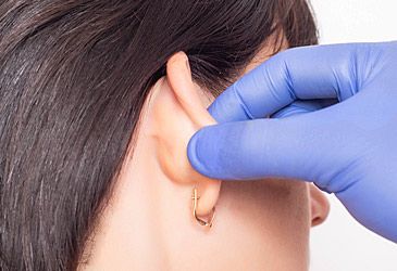 Which term denotes a procedure to pin or reshape the ears?