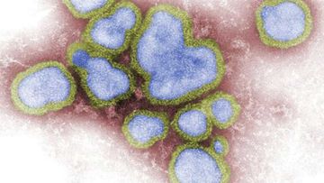 Influenza A is a particularly nasty virus spreading around Australia.