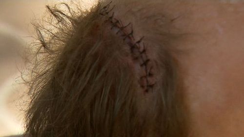 Mr Matthews cracked his head open in the ordeal, and was threatened with a Taser. Picture: 9NEWS