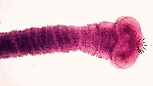 A microscopic image of the Taenia solium tapeworm.