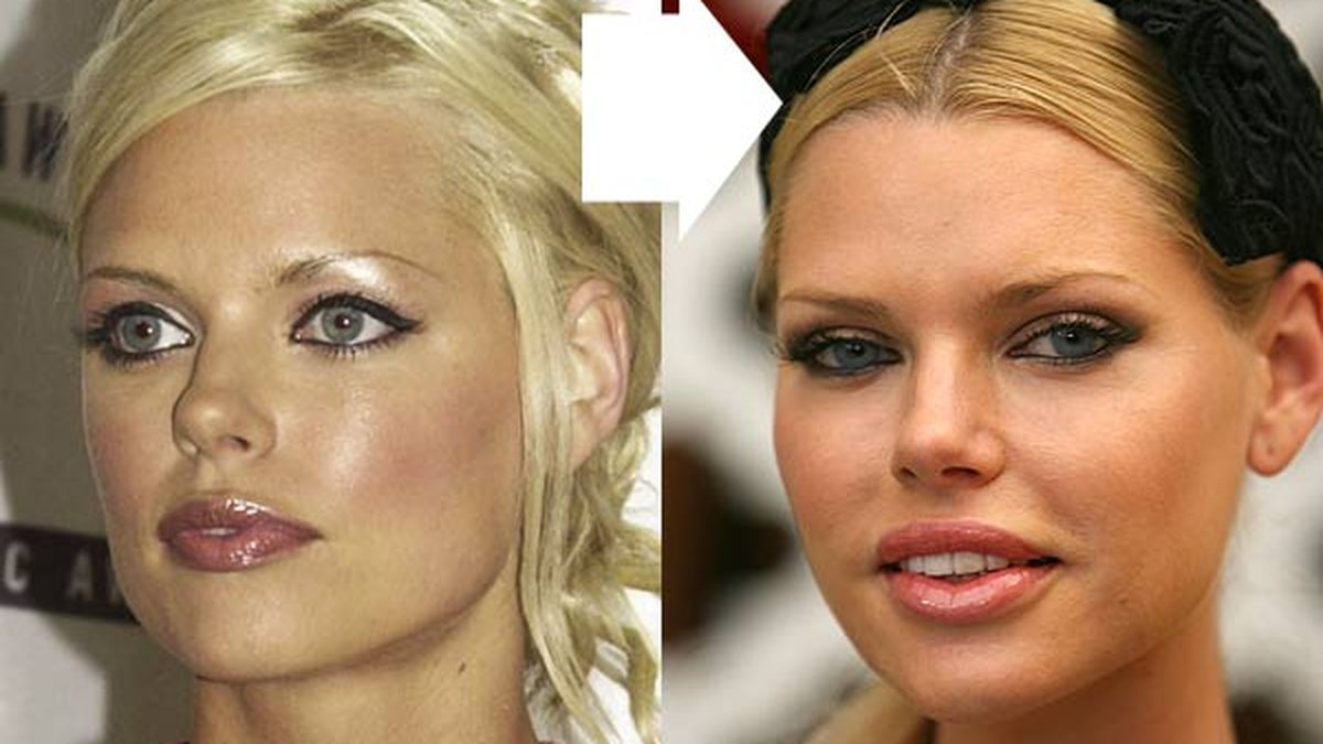 Sophie Monk regrets plastic surgery - 9Celebrity