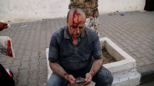 An injured man as a result of Israeli airstrikes