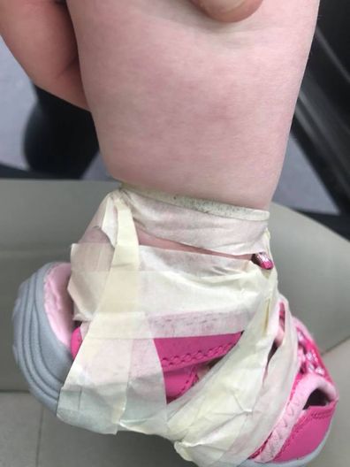 Mum blasts Clarks after shoe fitting left toddler with 'strap