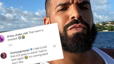 Drake reveals he suffered from hair loss after contracting COVID-19.