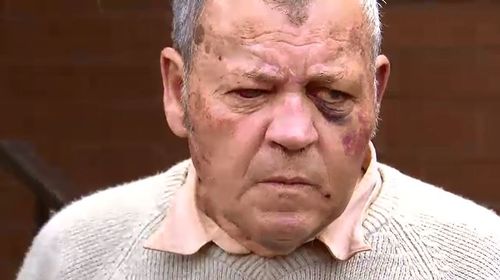Mr Janeczko suffered severe bruising and lacerations in the attack. (9NEWS)
