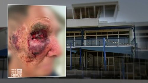 A 91-year-old great grandfather is living in fear after he was allegedly set upon by strangers in his car outside a Western Australian yacht club.