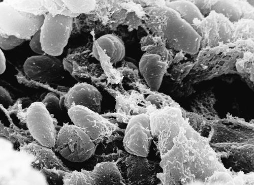 Although plague is inextricably linked to the Black Death pandemic of the 14th century that killed about 50 million people in Europe, it remains a relatively common disease.