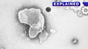 A human respiratory syncytial virus, also known as RSV.