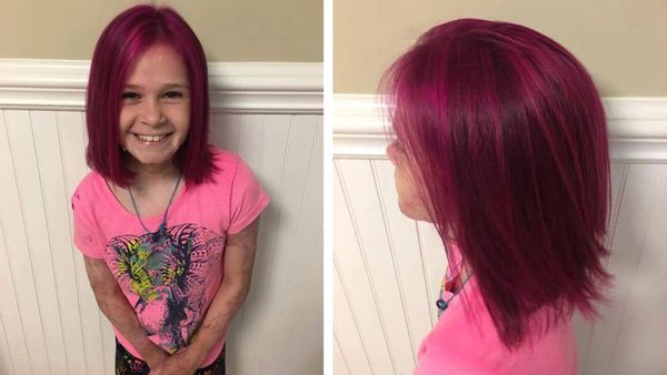 The Heartbreaking Reason Behind This Little Girl S Pink Hair