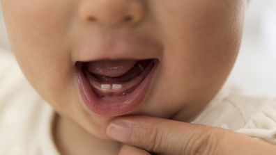 Baby with two teeth