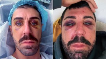 Victim of alleged assault on Oxford Street in Sydney outside gay nightclub