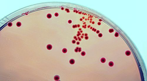 E. coli grown on an agar plate over night. 