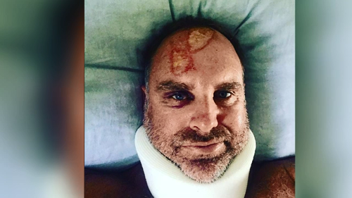 Matthew Hayden was in a neck brace for a month as his vertebrae healed.