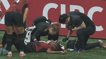 Canadian defender Kadeisha Buchanan was left with blood streaming from her head after a clash with Alanna Kennedy