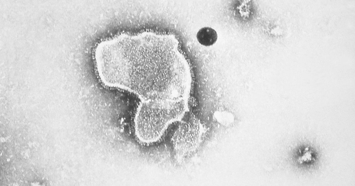 RSV cases ‘remain high’ in NSW, surpassing COVID-19 and flu cases