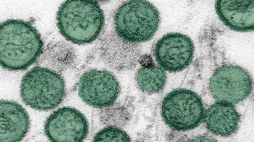 L'hantavirus visto al microscopio.