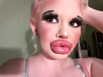 Andrea Emilova Ivanova aiming for the biggest lips in the world