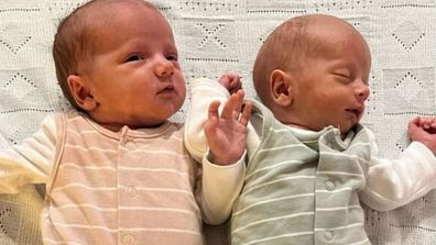 David and Sandra Searle superfetation twins