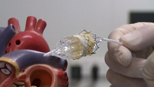 The breakthrough creation of a 3D heart valve is being touted as a cure for a deadly type of heart disease and it's currently under trial in Perth.