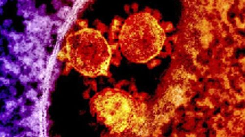 Coronavirus is being studied by scientists around the world in the hope of developing a vaccine.