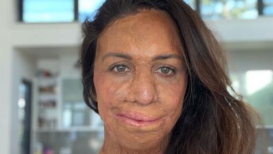 Turia Pitt