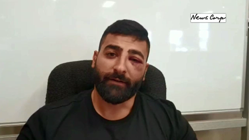 Khader Elali is unable to return to work until doctors give him clearance after his hearing aid was damaged in a road rage attack.