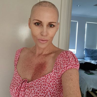 Nadine Hoffman breast cancer survivor mum