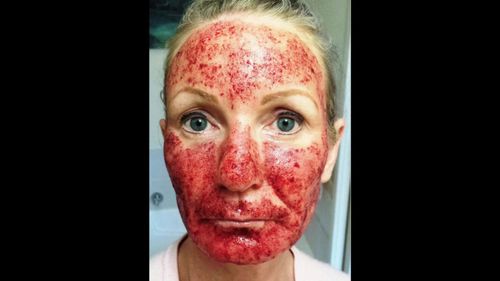 Niki Richardson claims she had a bad treatment at a salon.
