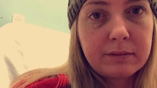 Sarah Joyce contracted meningococcal in 2016 and defied doctor's expectations to survive.