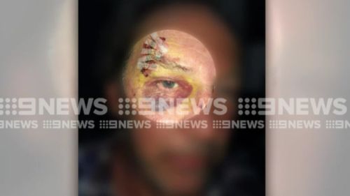 The man's daughter has accused police of using excessive force. (9NEWS)