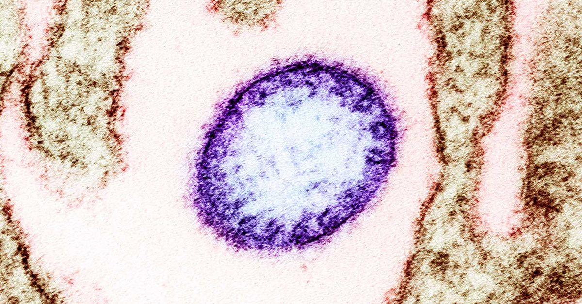 Australian government 'monitoring' Nipah virus closely