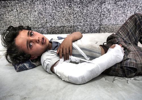 A young Yemeni boy lies in the emergency room awaiting treatment. (Getty)