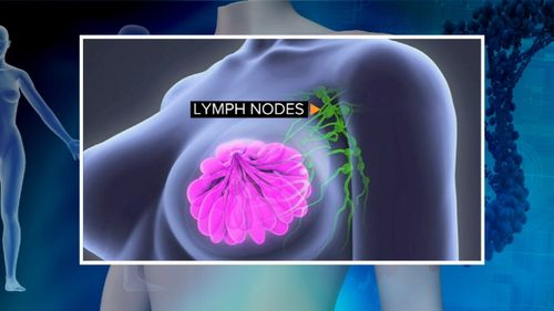 The trial is testing whether women can safely avoid further surgery when one or two key nodes show small tumour deposits. (9NEWS)