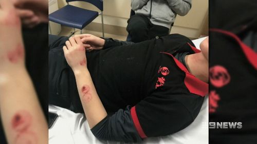 Mr Kong's injuries following the alleged attack. (9NEWS)